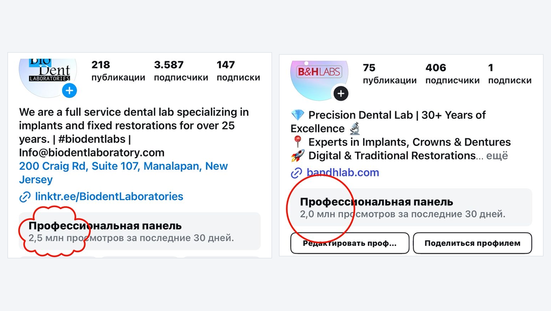 Bio-Dent Laboratories · Instagram (US): 2.5M просмотров за 30 дней